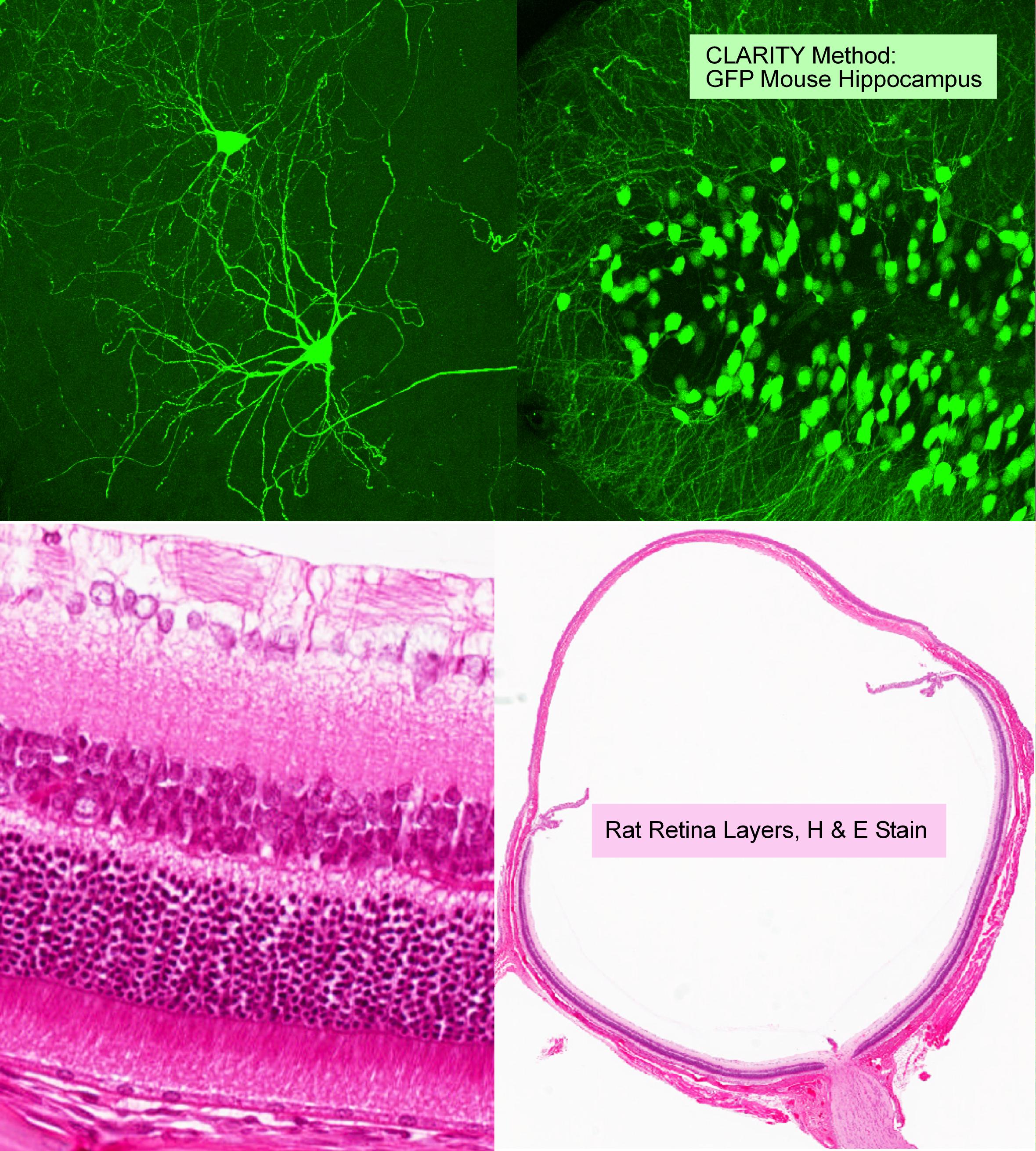 CLARITY Method GFP Mouse Hippocampus /  Rat Retina Layers, H&E Stain